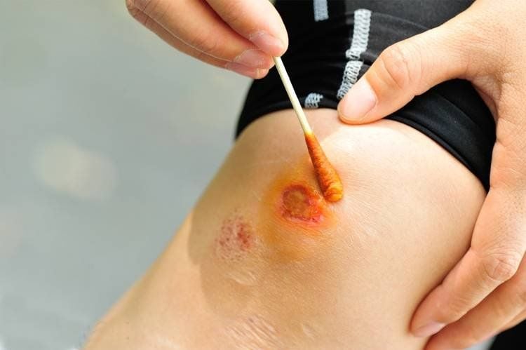 đăng ký chế phẩm sát khuẩn dùng trong y tế